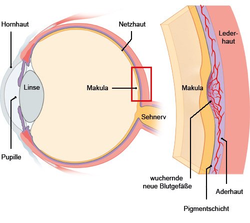de auge amdjpg replacement image
